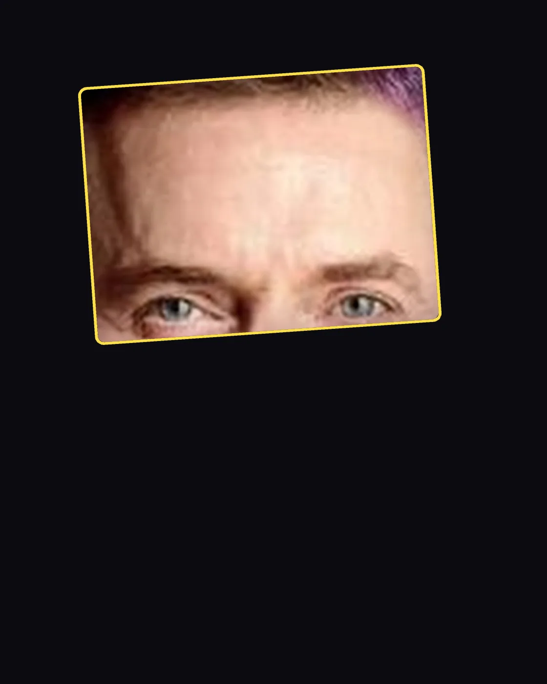 Close crop of a famous person’s hair and forehead