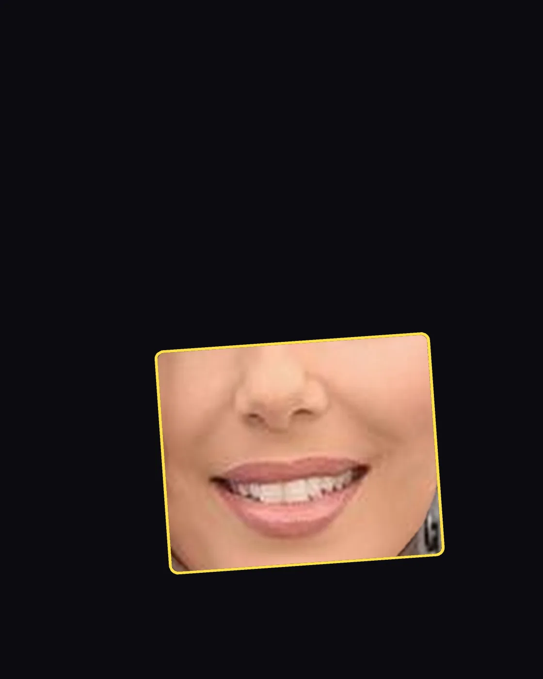Close crop of a famous person’s nose and jawline