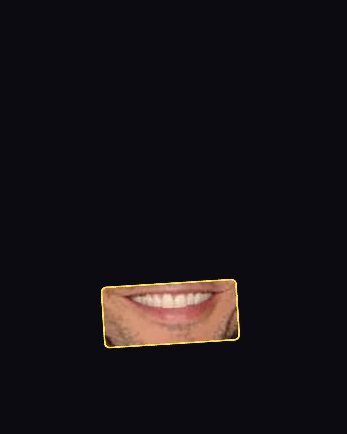 Close crop of a famous person’s lips and smile