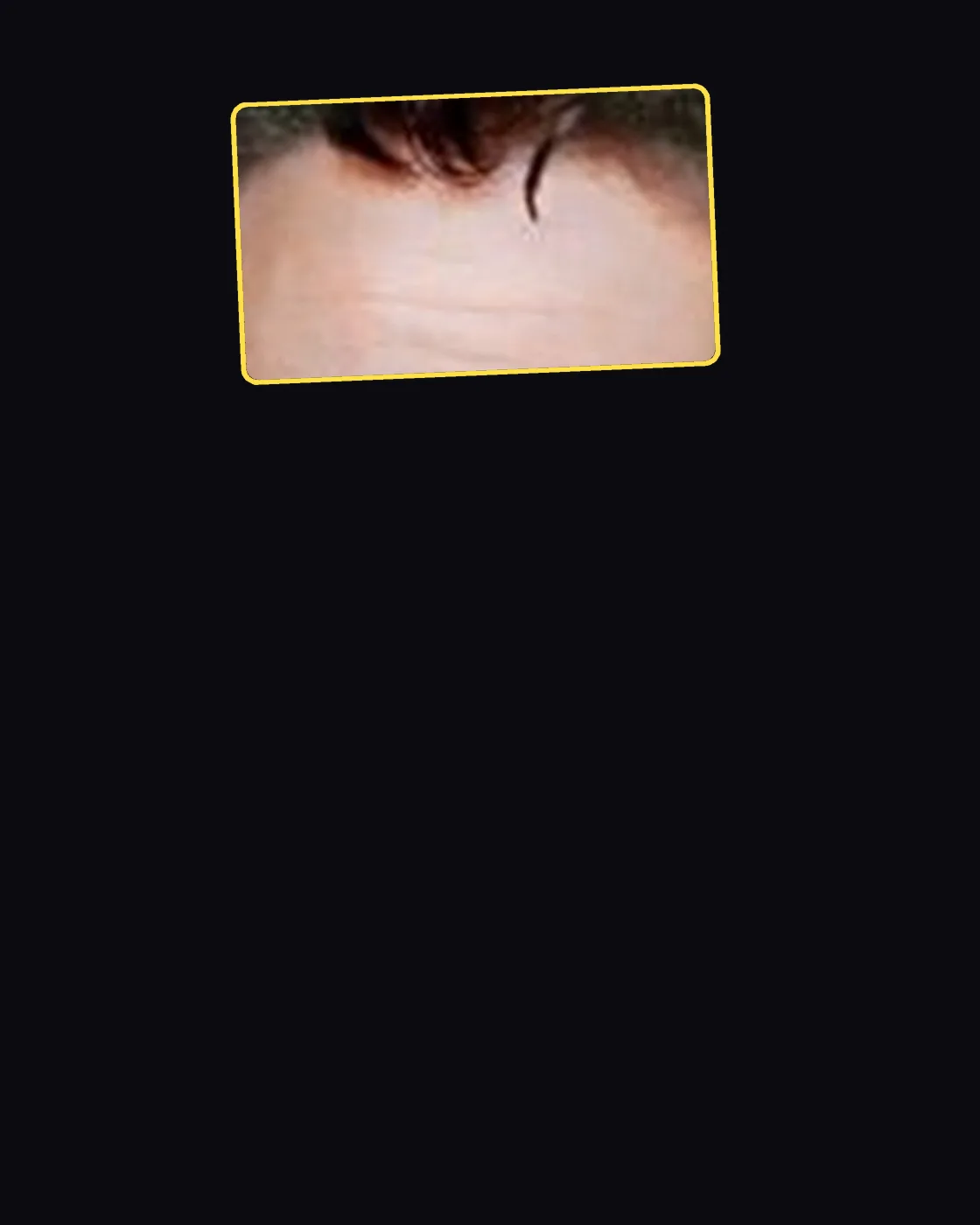Close crop of a famous person’s hair and forehead