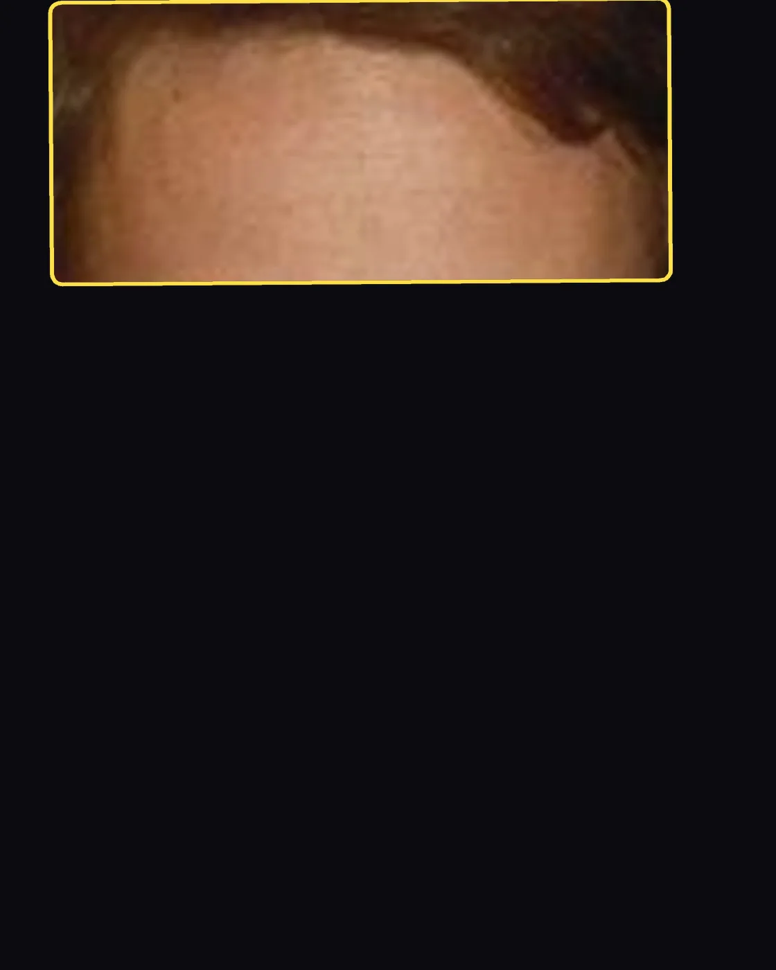 Close crop of a famous person’s hair and forehead