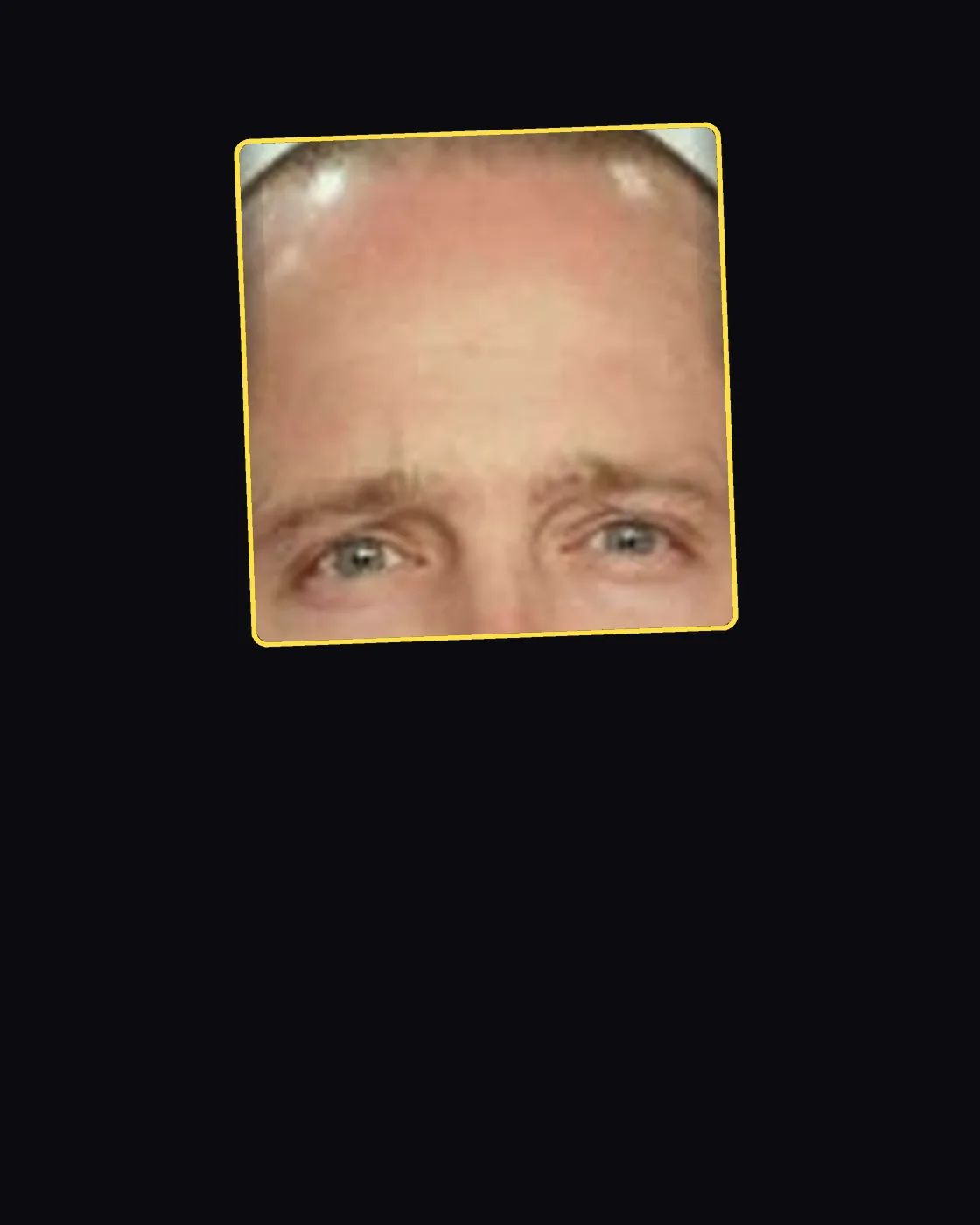 Close crop of a famous person’s hair and forehead