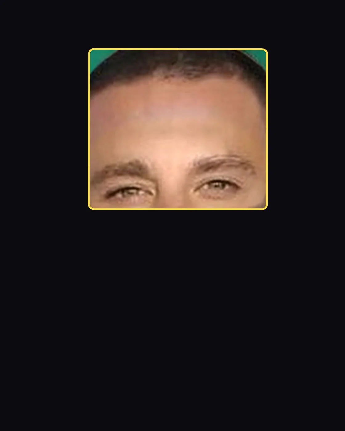 Close crop of a famous person’s hair and forehead
