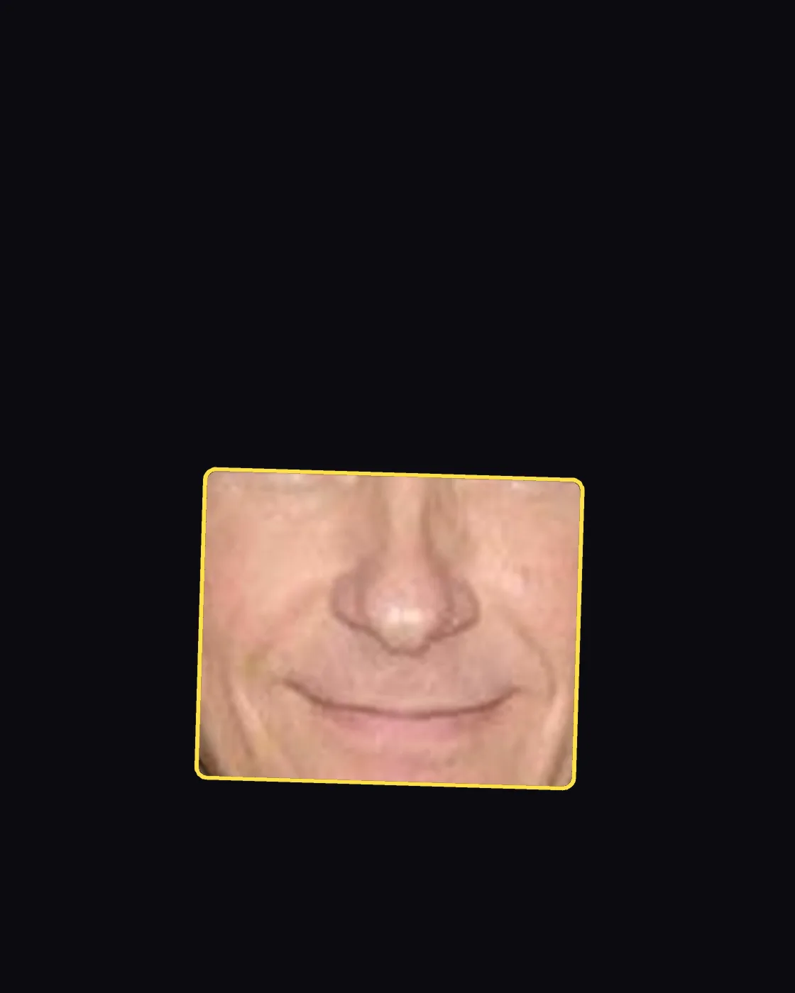 Close crop of a famous person’s nose and jawline